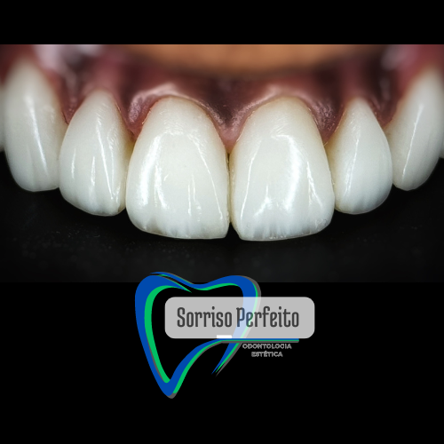 Foto 2 de Sorriso Perfeito Clinica Odontologica