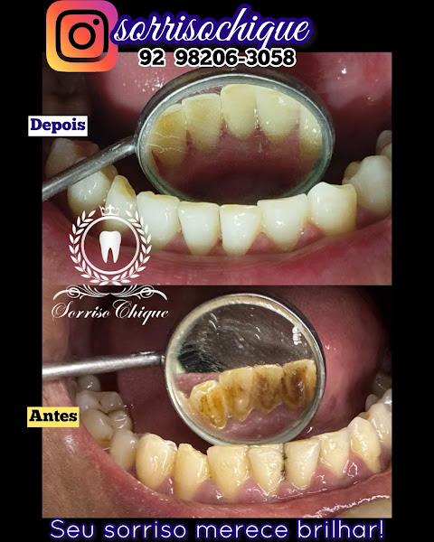 Foto 2 de sorrisochique