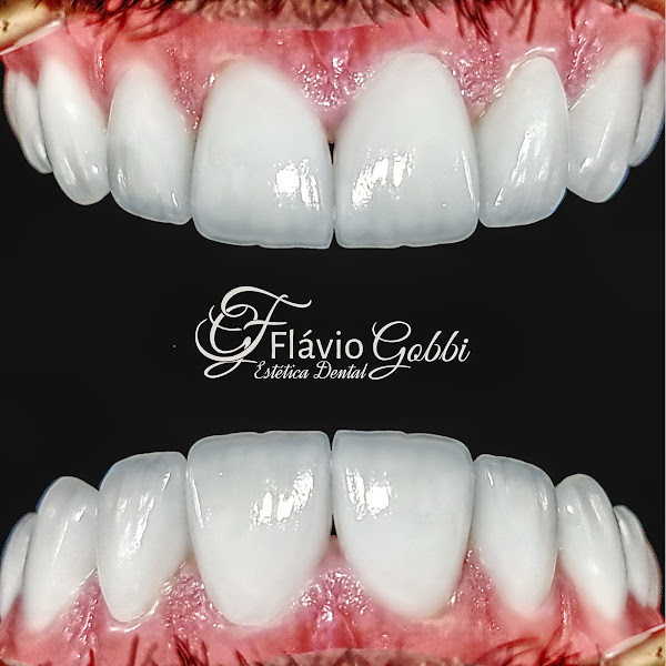 Foto 3 de Sorrisos e Face Dr. Flávio Gobbi e Dra. Edléia Gobbi