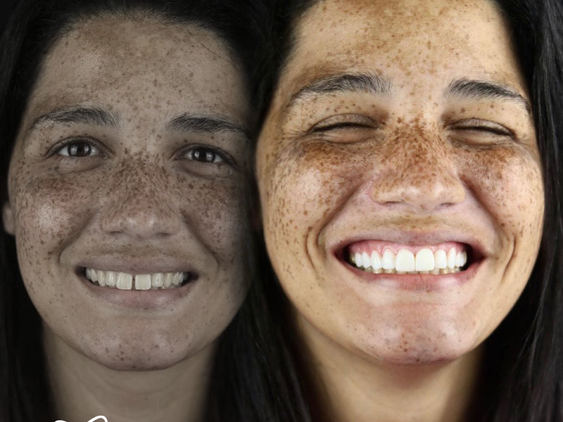 Foto 8 de Sorrisos Mais que Especiais