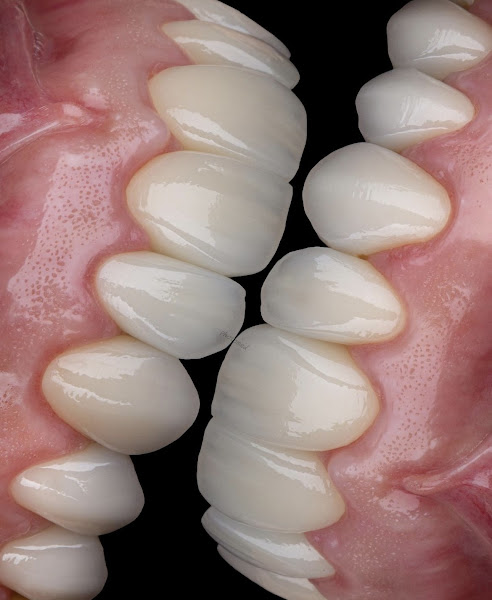 Foto 3 de Sorrivix Clínica Odontológica Implantes e Facetas