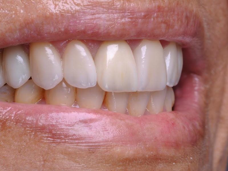 Foto 8 de Sorrivix Clínica Odontológica Implantes e Facetas