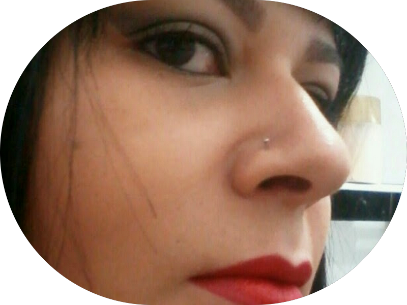 Foto 5 de Sorrix: Ortodontia, Implantes Dentários e Endodontia em Sorocaba SP