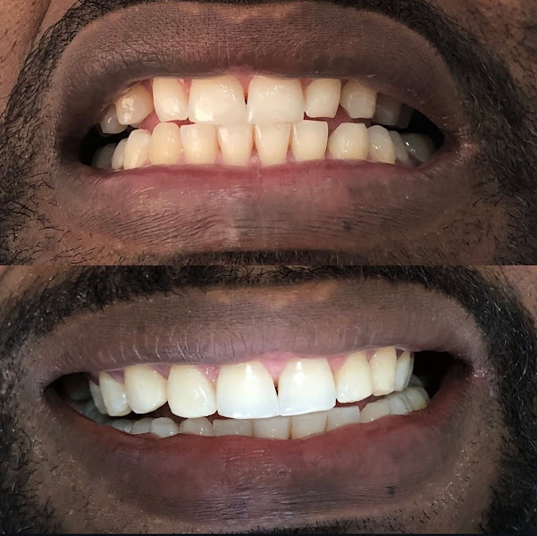 Foto 2 de SOS Dente Penha | Emergência dentista