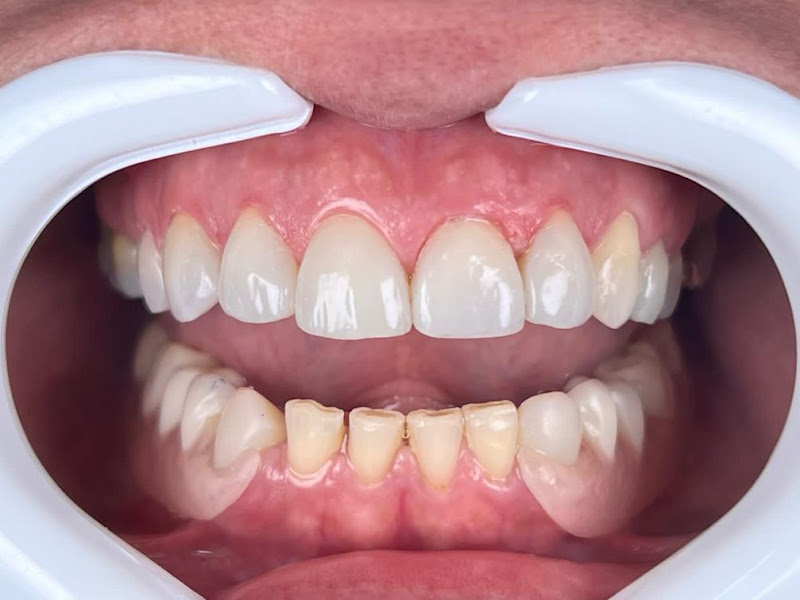 Foto 8 de Souria Odontologia | Implante Dentário | Clínica Odontológica | Dentista em Volta Redonda RJ