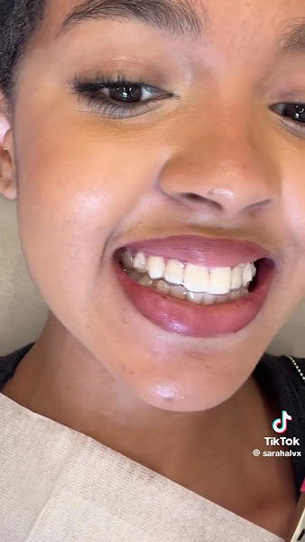 Foto 3 de SouSmile | Pinheiros | Unidade Oficial