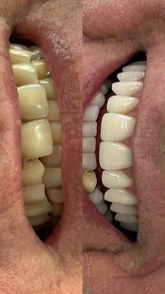 Foto 2 de Souzimplante Odontologia