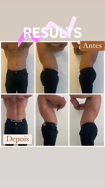 Foto 3 de Spazio Porto | Clínica de Estética Avançada