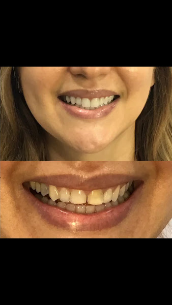 Foto 4 de Spazio Uno