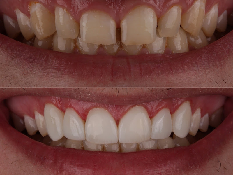 Foto 3 de Splend Odontologia Estética - Dentista em Cascavel