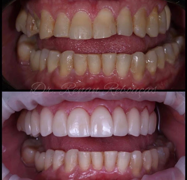 Foto 2 de SR Odontologia Especializada - Dra. Thainara Salgueiro