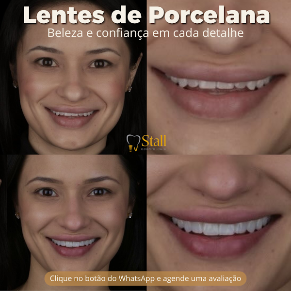 Foto 2 de Stall Legacy Odontologia