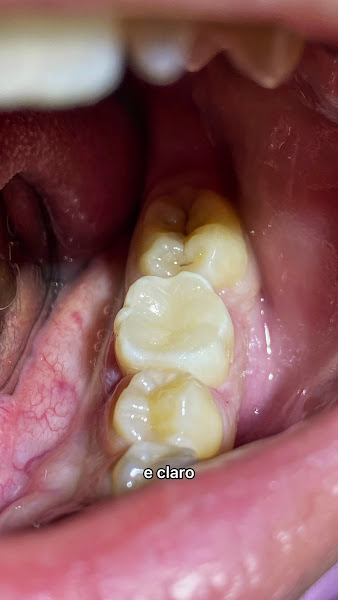 Foto 3 de Star Odonto