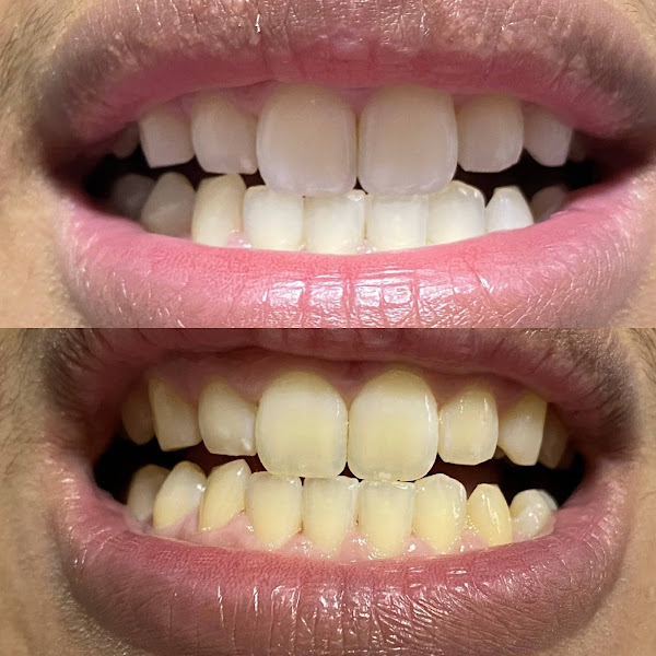 Foto 3 de Stefanini Odontologia