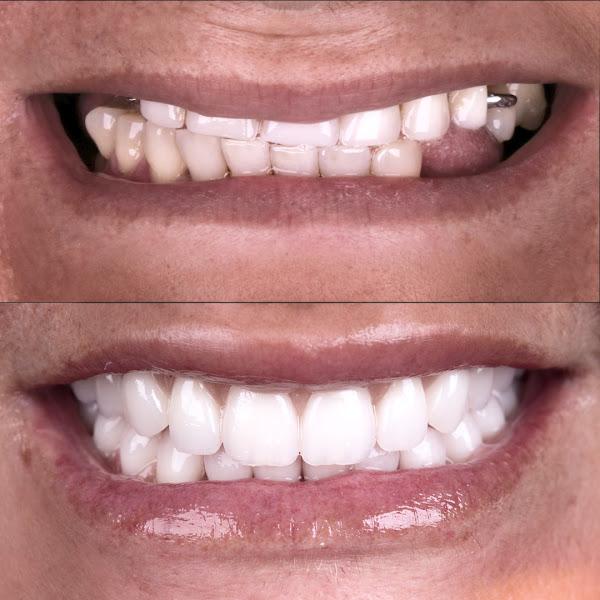 Foto 2 de Stellare Smile Forever