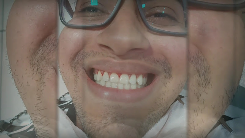 Foto 3 de Stilo Implantes