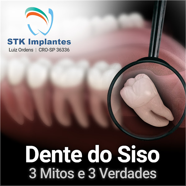 Foto 3 de STK Implantes / Dr Luiz Ordens