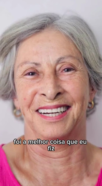 Foto 4 de Stories Odontologia Divinópolis - Implante e Prótese Fixa