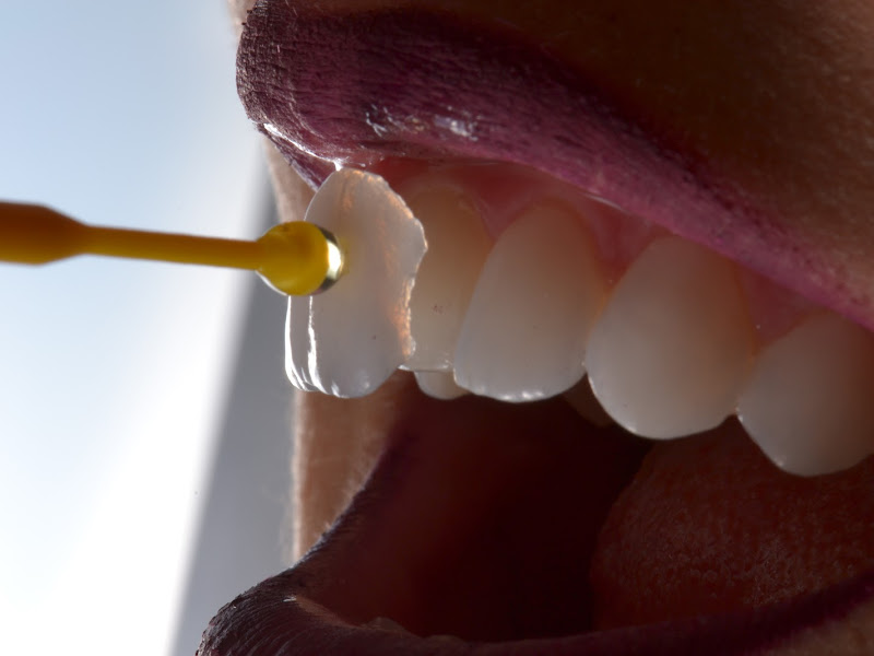 Foto 13 de Strapazzon | Clínica Odontológica em Brasília na Asa Sul