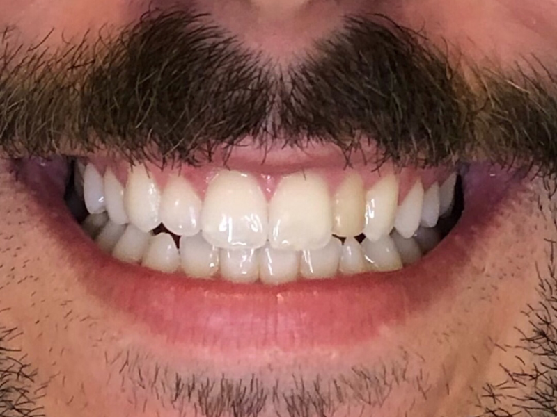 Foto 5 de Strazzanti Odontologia em Santo André SP