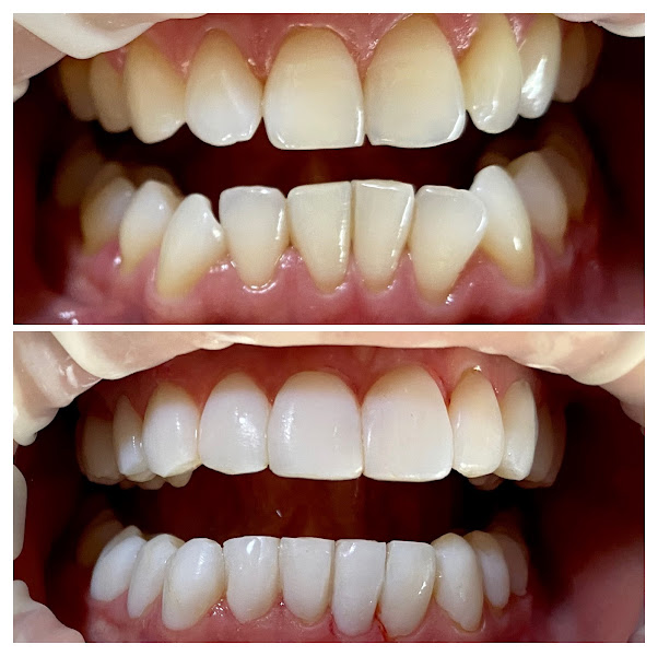 Foto 3 de Stuani Odontologia