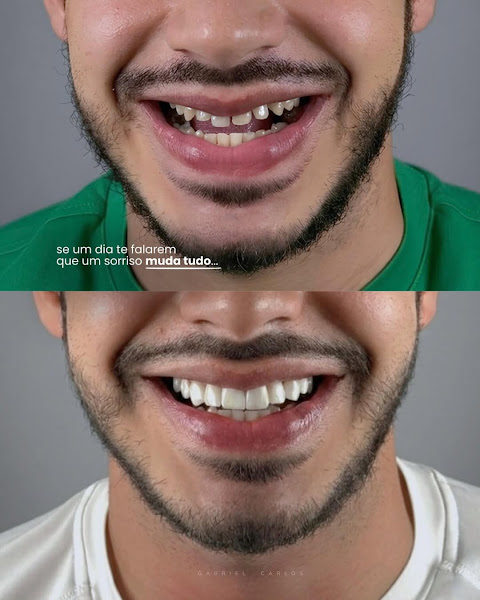 Foto 2 de Studio Dental - Dr. Gabriel Carlos | Dentista Arapiraca