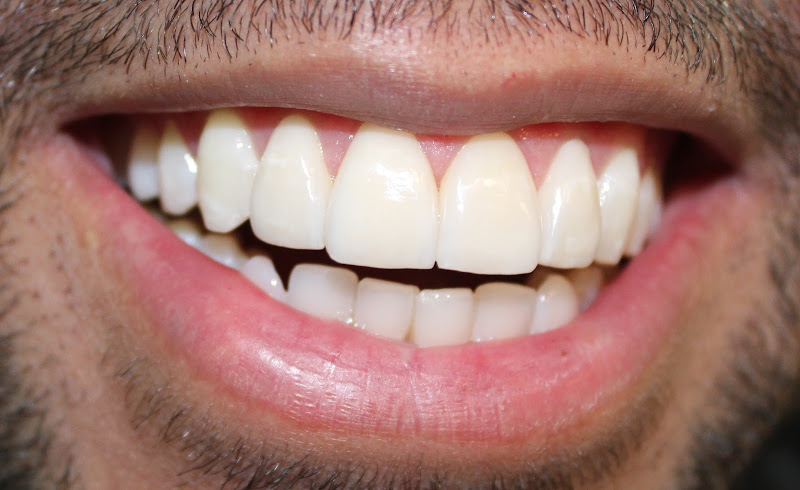 Foto 3 de Studio Dentalis - Dr. Murillo M. Melo