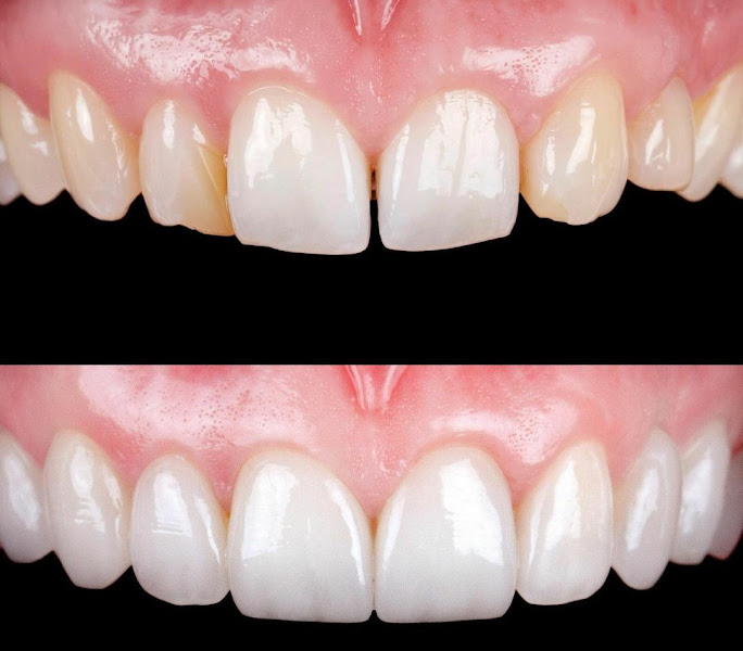 Foto 2 de Studio Linhares odontologia de resultados