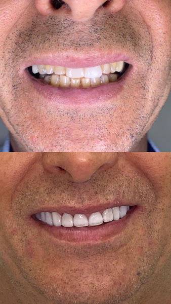 Foto 3 de Studio Moreira de Odontologia - Dr Denner Moreira