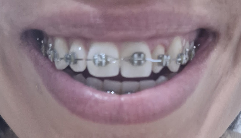 Foto 3 de Studio Odontológico | Dentista Vitória da Conquista