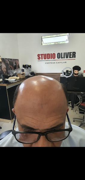 Foto 3 de Studio oliver / prótese capilar