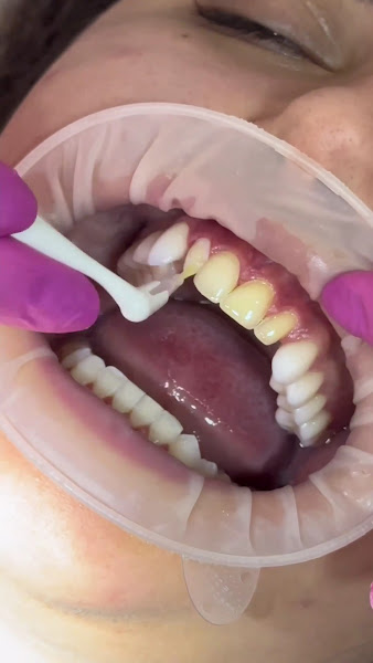 Foto 3 de Studio Oral e Facial Cirurgia Ortognatica Invisalign Dentistas