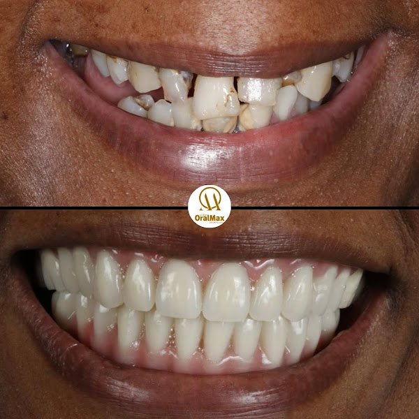 Foto 2 de Studio Oralmax Odontologia | Dentista Itaigara | Dentista na Pituba | Dentista Em salvador