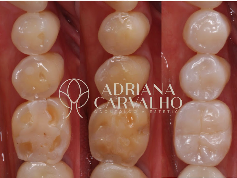 Foto 9 de Sua Dentista em casa - Odontologia Domiciliar