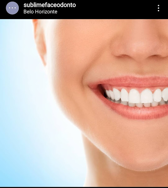 Foto de Sublime Face