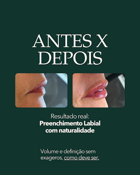 Foto 3 de Sumaré Odonto - Urgências Odontológicas