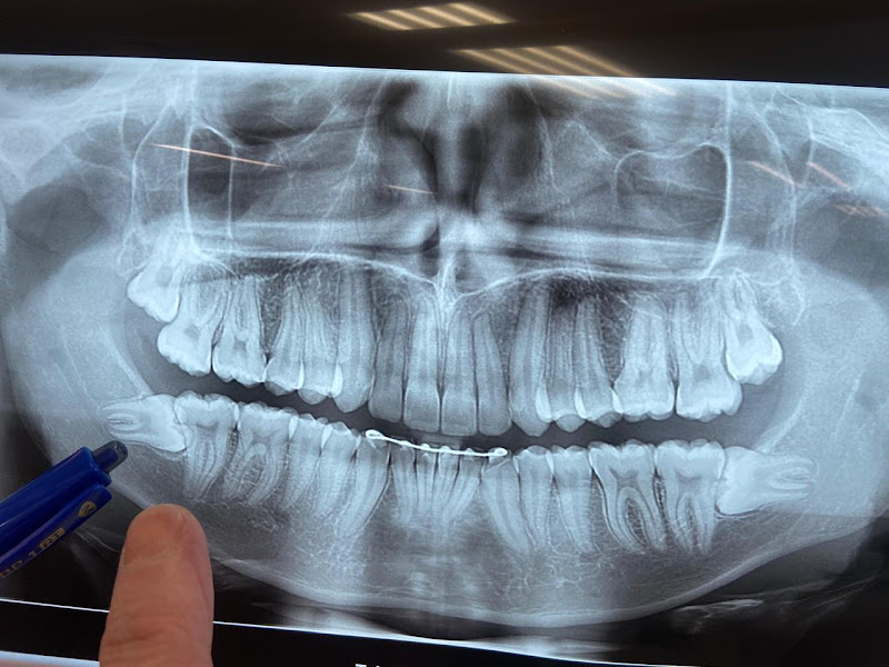Foto 5 de Sumaré Odonto - Urgências Odontológicas