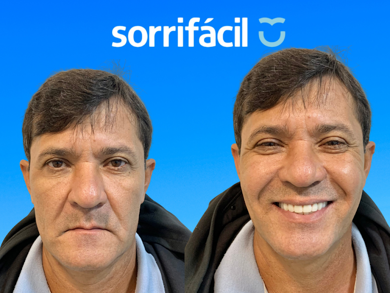 Foto 9 de Supera Odontologia Especializada