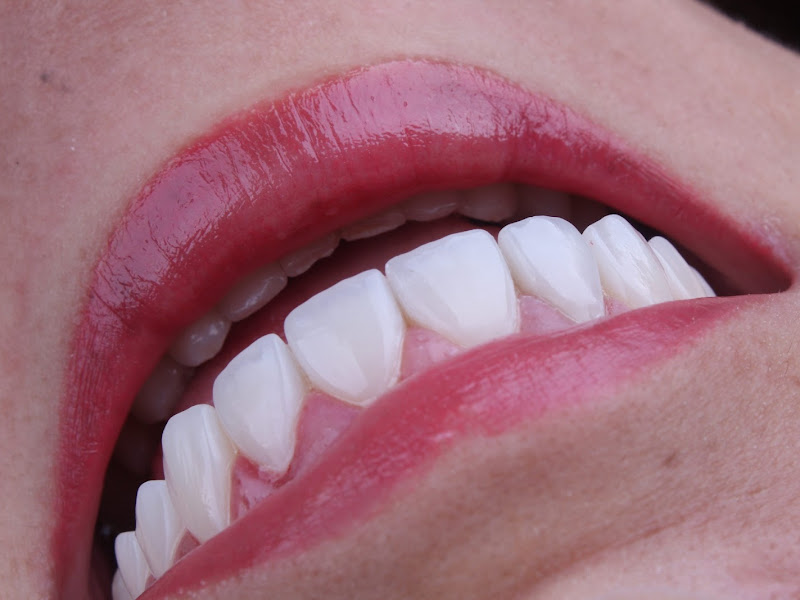 Foto 7 de Superiore Odontologia