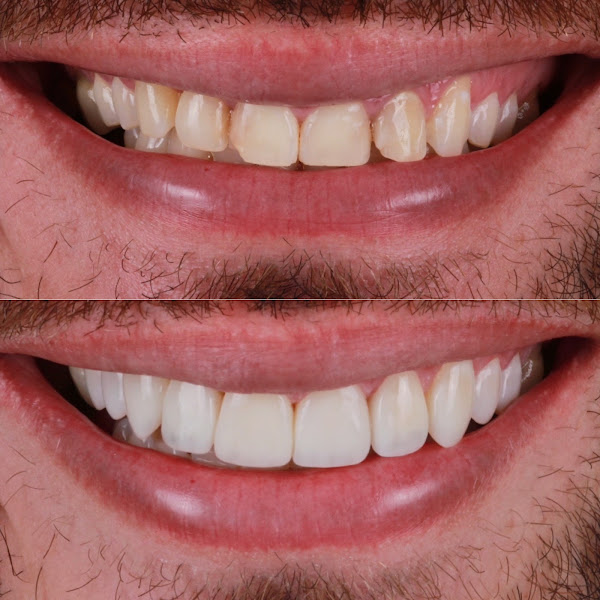 Foto 3 de T Clinic Odontologia- Dra Taiza Ferreira