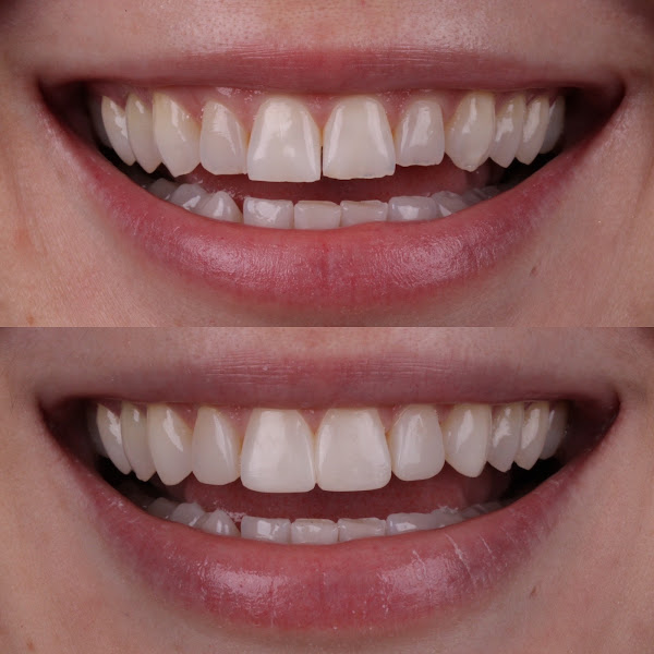 Foto 3 de Taís Custódio Odontologia Estética