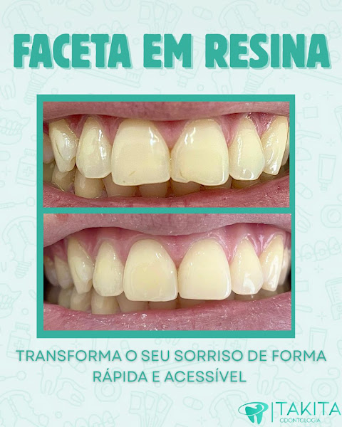 Foto 3 de Takita Odontologia - Invisalign