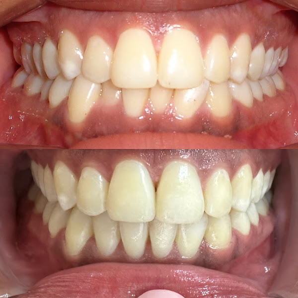 Foto 2 de Tambourgi Odontologia Especializada - Implantes/ Invisalign / Facetas / Harmonização Facial