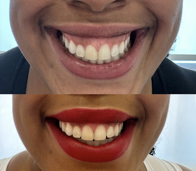 Foto 3 de Tambourgi Odontologia Especializada - Implantes/ Invisalign / Facetas / Harmonização Facial
