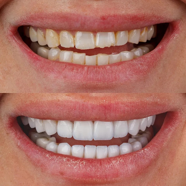 Foto 2 de TANFERRI Prótese Dentária