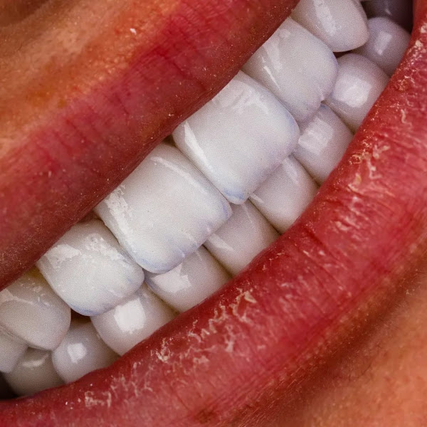 Foto 3 de TANFERRI Prótese Dentária
