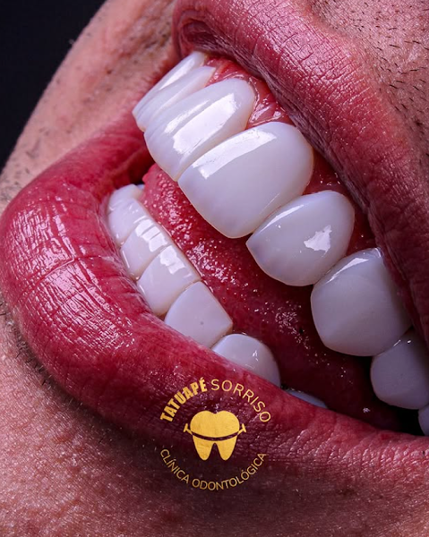 Foto 2 de Tatuapé Sorriso BH Clínica Odontológica, Referência Lentes de Resina/Porcelana, Dentista funcionários, Belo horizonte
