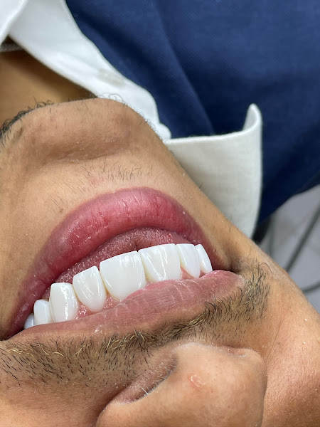 Foto 3 de Tatuapé Sorriso BH Clínica Odontológica, Referência Lentes de Resina/Porcelana, Dentista funcionários, Belo horizonte