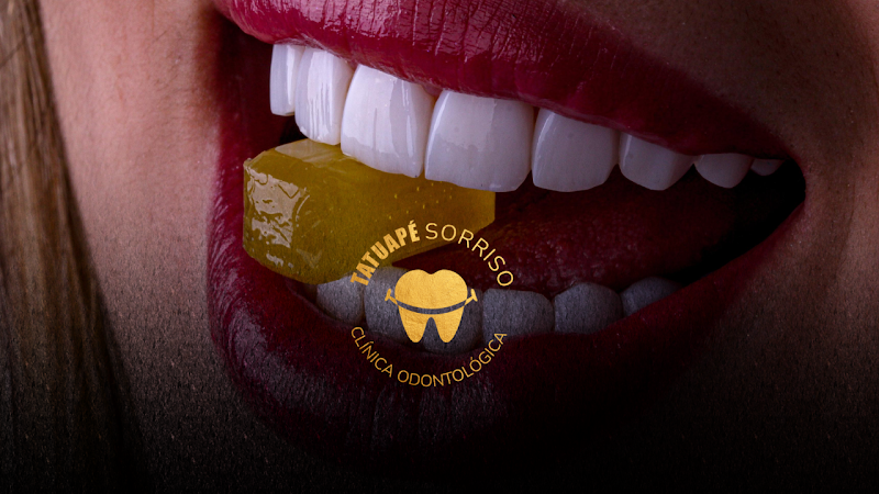 Foto 2 de Tatuapé Sorriso Clínica Odontológica, Referência Lentes de Resina/Porcelana, Dentista Tatuapé
