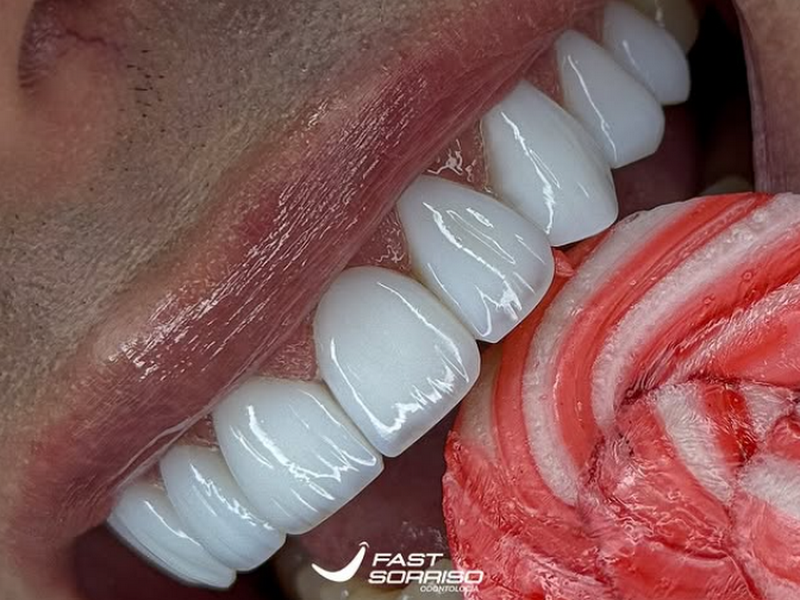 Foto 8 de Tatuapé Sorriso Clínica Odontológica, Referência Lentes de Resina/Porcelana, Dentista Tatuapé
